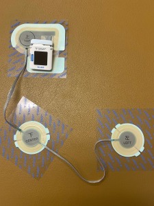 ホルター心電計