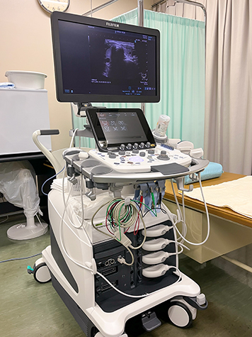 エコー検査機器の写真1